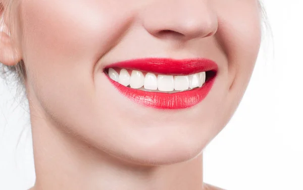 Dientes blancos y labios rojos. Sonrisa femenina perfecta después de blanquear los dientes . — Foto de Stock