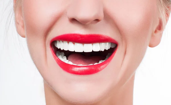 Dentes brancos e lábios vermelhos. Sorriso feminino perfeito depois de clarear os dentes . — Fotografia de Stock