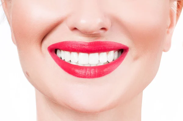 Dentes brancos e lábios vermelhos. Sorriso feminino perfeito depois de clarear os dentes . — Fotografia de Stock