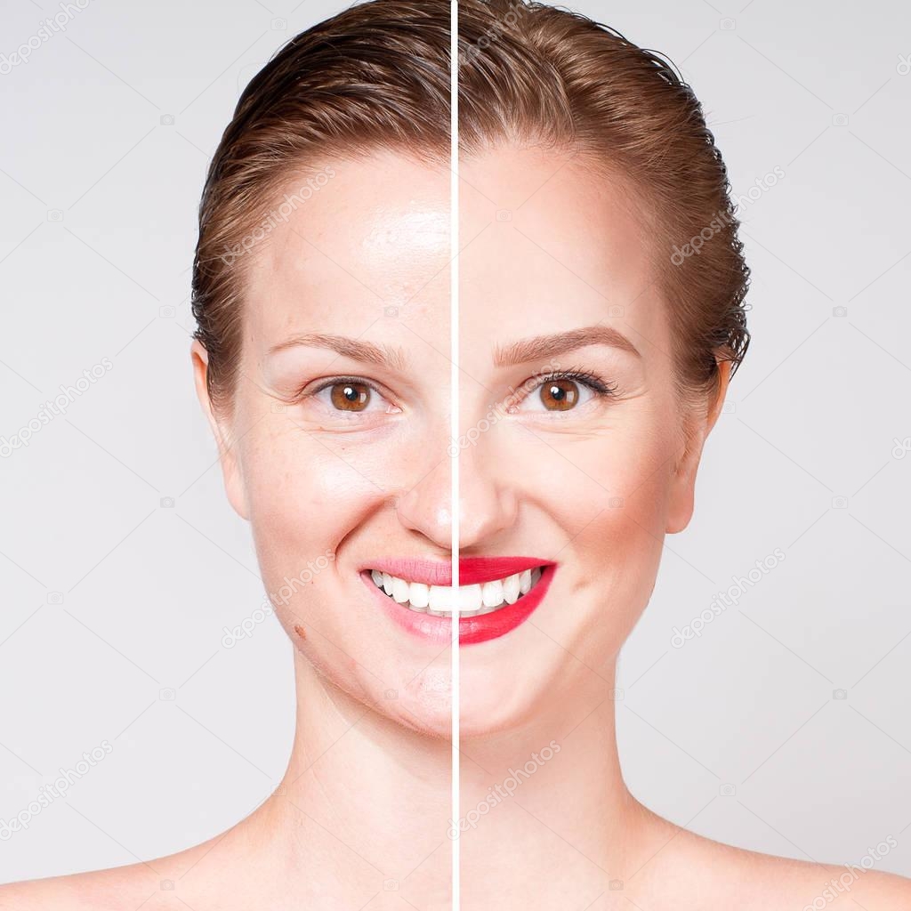 Woman before and after cosmetic or plastic procedure