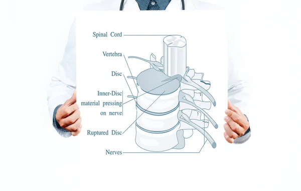 Medicine. Doctor and  anatomical spine. — Stock Photo, Image