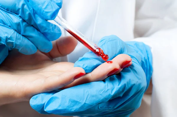 Lékař a pacient. Krevní zkouška prstem. — Stock fotografie