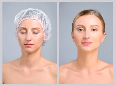 Portrait of female face, before and after plastic surgery  clipart