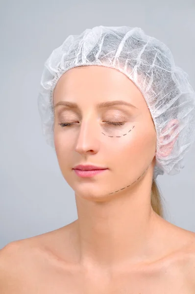 Plastikkirurgi. Kvinna med perforation linjer i ansiktet. Anti-aging behandling och face lift — Stockfoto