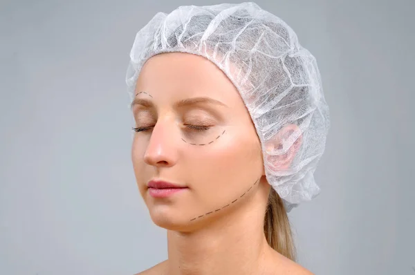 Chirurgie plastique. Femme avec des lignes perforées sur le visage. Traitement anti-âge et lifting — Photo