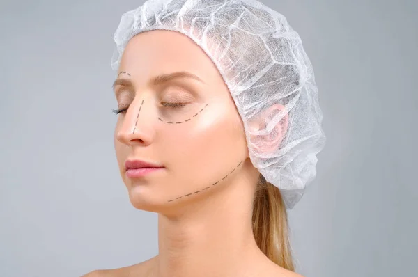 Cirugía plástica. Mujer con líneas de perforación en la cara. Tratamiento antienvejecimiento y lifting facial — Foto de Stock