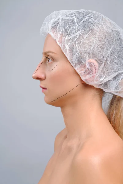 Kvinna före plastikkirurgi. Näsplastik. Anti-aging behandling och face lift. — Stockfoto