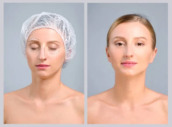 Portrait du visage féminin, avant et après la chirurgie plastique — Photo