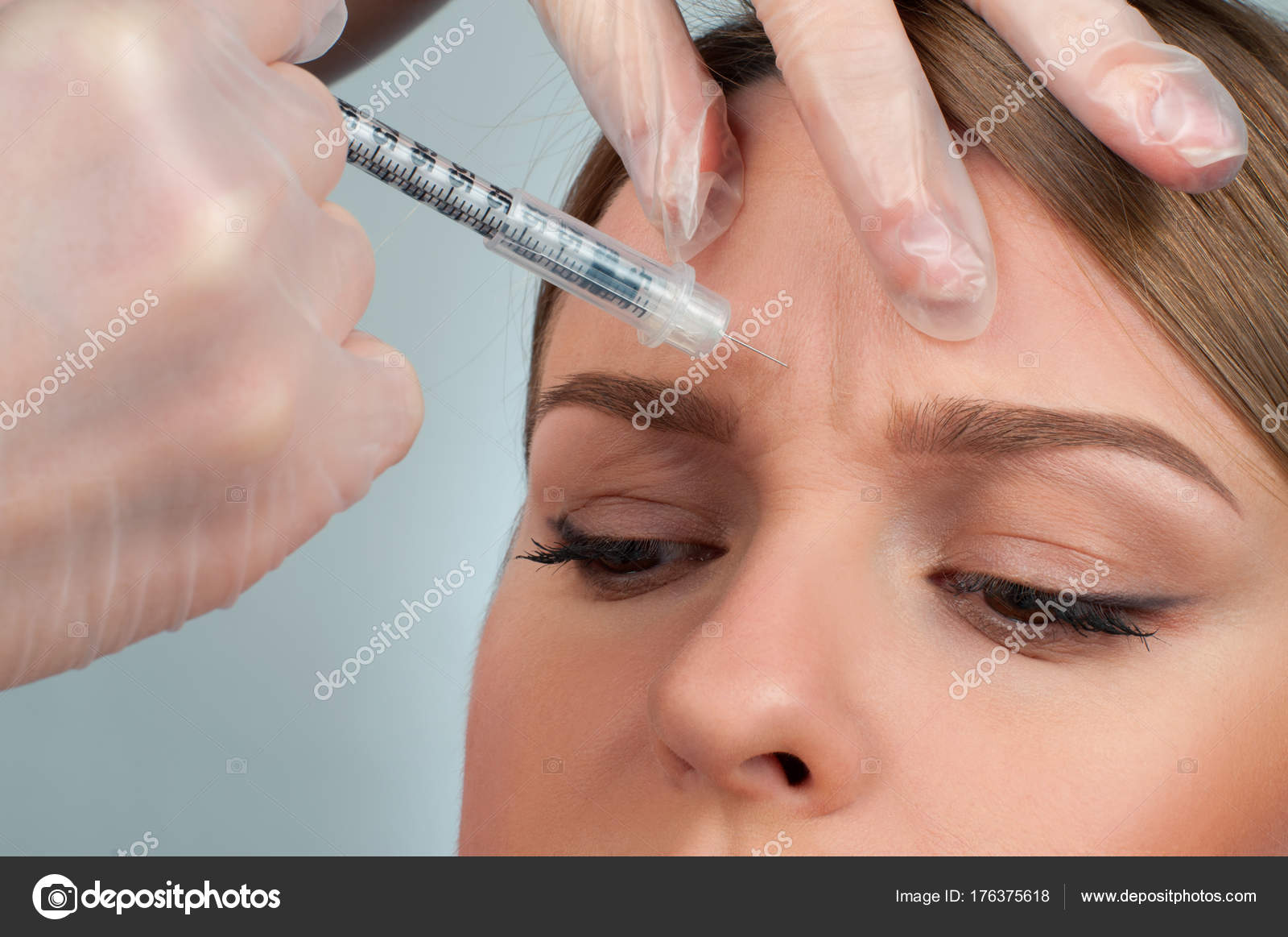 Инъекции диспорта. Уколы ботокса. Рекомендации перед ботоксом. Ботокс укол ложиться. Ботокс укол ложиться.