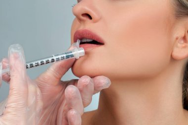 Güzel kız dolgu enjeksiyonu dudaklarında alma. Plastik cerrahi.