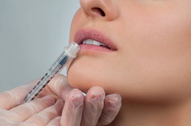 Güzel kız dolgu enjeksiyonu dudaklarında alma. Plastik cerrahi.