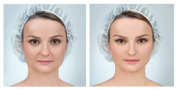 Retrato da face feminina, antes e depois da cirurgia plástica — Fotografia de Stock