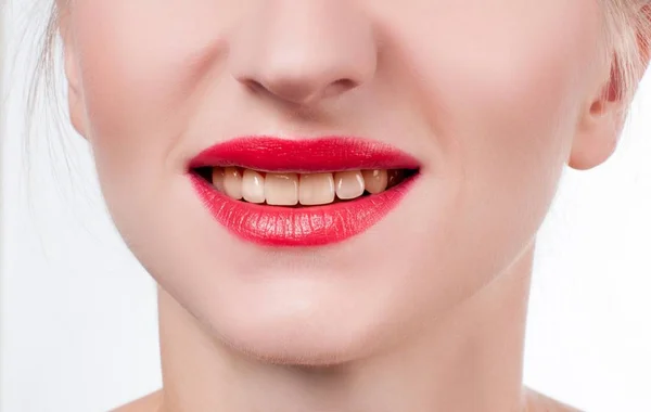 Жіночі зуби перед відбілюванням. Відбілювання зубів у стоматолога . — стокове фото