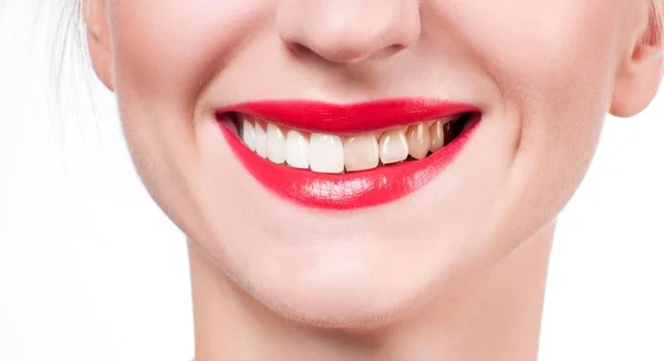 Жіноча посмішка до і після відбілювання. Відбілювання зубів . — стокове фото