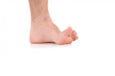 Kaşıntı ayak. Enfeksiyon mantar neden ayak.