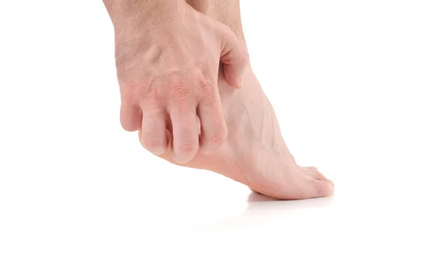 Człowiek porysować swędzenie ręką. Zakażenie, spowodowane przez grzyb stóp. — Zdjęcie stockowe
