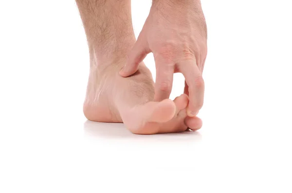 Człowiek porysować swędzenie ręką. Zakażenie, spowodowane przez grzyb stóp. — Zdjęcie stockowe
