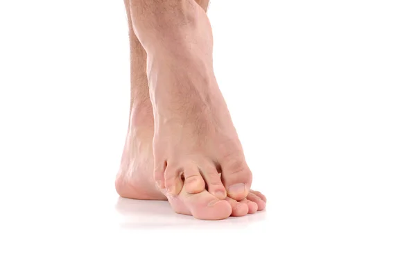 Man scratch the itch.  Infection of the feet caused by fungus. — Stock Photo, Image