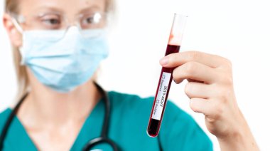 2019-NCoV. Laboratuvardaki bilimsel numuneye bakan bilim adamı doktor Coronavirus aşısını araştırıyor. Coronavirus covid-19 kan örneği tüpü tutan doktor.