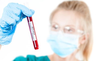 2019-NCoV. Laboratuvardaki bilimsel numuneye bakan bilim adamı doktor Coronavirus aşısını araştırıyor. Coronavirus covid-19 kan örneği tüpü tutan doktor.