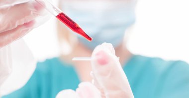 COVID-19 testi. Laboratuvardaki bilimsel numuneye bakan bilim adamı doktor Coronavirus aşısını araştırıyor. 2019-nCoV Kan Numunesi.