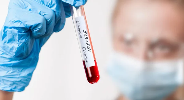 2019 Ncov Lekarz Prowadzący Patrząc Próbkę Naukową Laboratorium Bada Szczepionkę — Zdjęcie stockowe