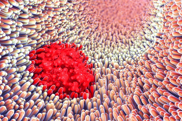 bağırsak villus ve mide ülseri mikroskobik closeup 3D çizimi