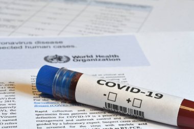 Floransa, Mayıs 2020: Coronavirus (COVID-19) tübü için kan testi örneklerinin ayrıntıları.