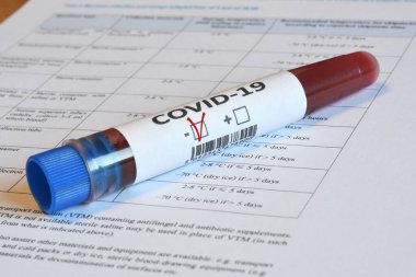 Floransa, Mayıs 2020: Koronavirüsün (COVID-19) varlığına dair kan testi örnekleri negatif kan örneği içeriyor.