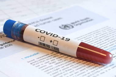 Floransa, Mayıs 2020: Coronavirus (COVID-19) tübü için kan testi örneklerinin ayrıntıları.