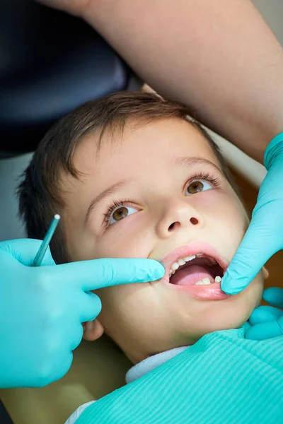 Junge beim Zahnarzt an der Rezeption öffnete den Mund in der Klinik — Stockfoto