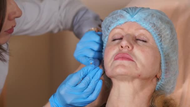 Doutor faz uma punção da pele com os enchimentos de preparações de cânula . — Vídeo de Stock
