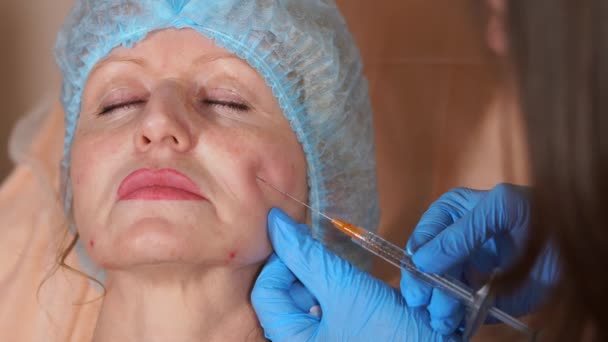 Lékař vloží implantáty utáhnout tvář ženy středního věku. — Stock video