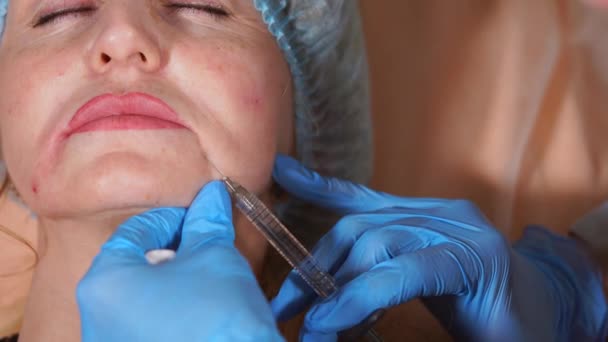 Nära upp skott av womens huden lyfta processen med fyllmedel, utan kirurgi — Stockvideo