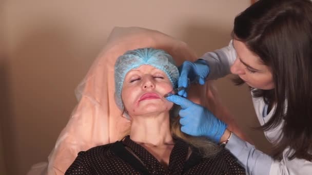 Botulinum injected into the area of the paranasal folds to get rid of wrinkles — Stock Video