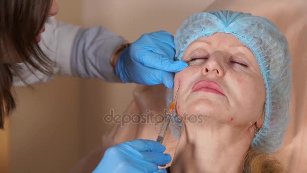 De arts schoonheidsspecialiste injecteert de canule in de Wang van een middelbare leeftijd vrouw. — Stockvideo