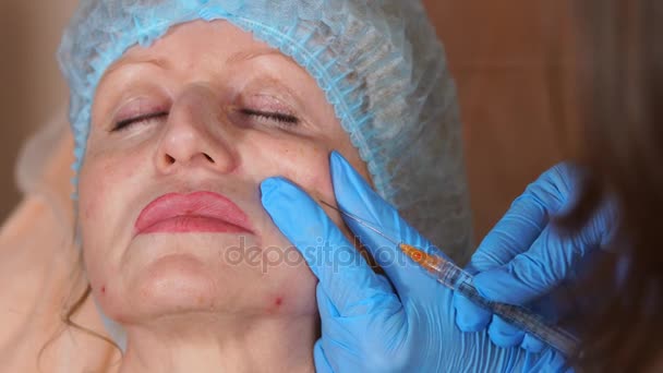 Gros plan du visage d'une femme qui s'injecte de l'acide hyaluronique . — Video