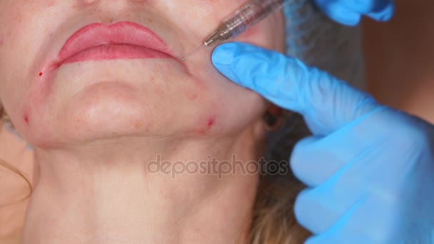 Primer plano de la cara, botulinoxina se inyecta para suavizar las arrugas faciales — Vídeos de Stock