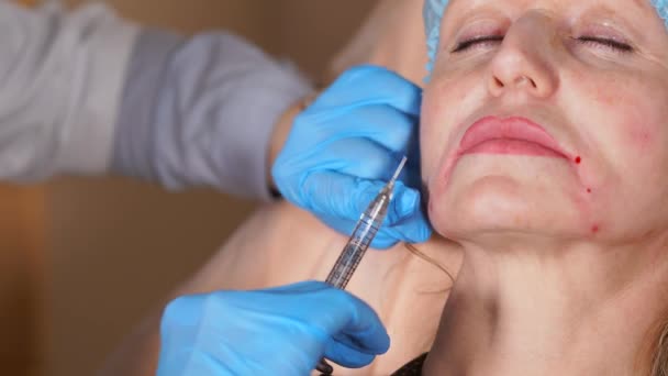 Крупный план процедуры введения ботокса для разглаживания морщин на лице — стоковое видео