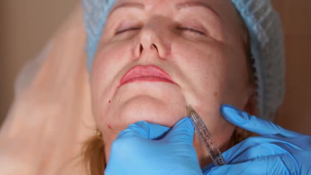 Close up shot of the womans face, which is now being injected with Botox — Stock Video