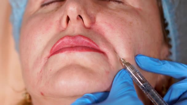 Close up shot of the process of introducing Botox — Stock Video