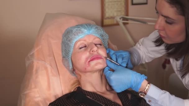 Thw doctor fait les dernières injections de Botox pour enlever les plis nasolabiaux — Video