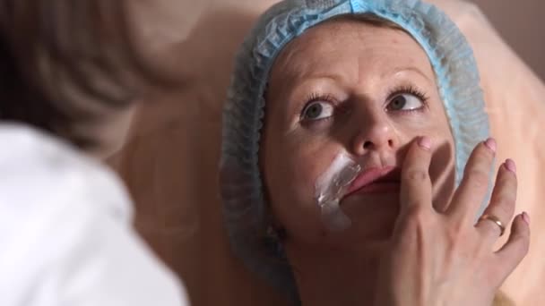De arts past een zalf op de circumfluous plooien voor vrouw voor injectie — Stockvideo