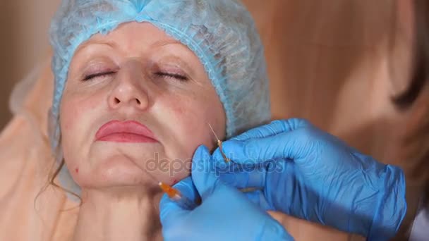 The doctor injects implants to tighten the face of a middle-aged woman — Stock Video