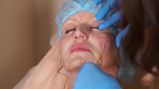 Zbliżenie twarzy kobiety, która jest wstrzykiwany lek z kwasem hialuronowym. — Wideo stockowe