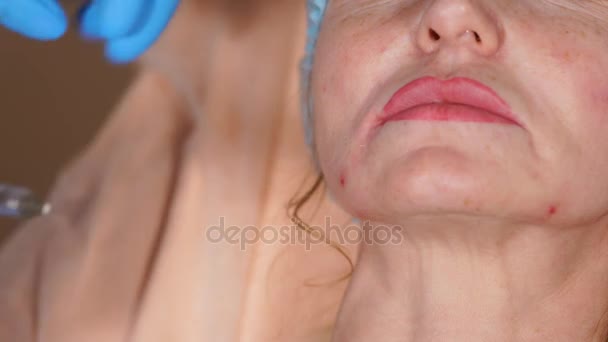 Un colpo viene sparato al volto di una donna di mezza età, dove viene iniettato botox — Video Stock