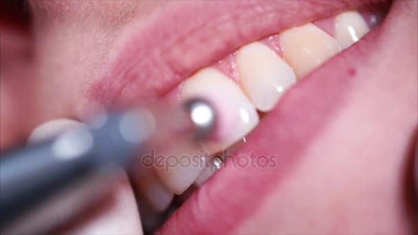 Close up tiro de uma boca de mulher, que escovar os dentes, dentista ajuda com uma escova — Vídeo de Stock