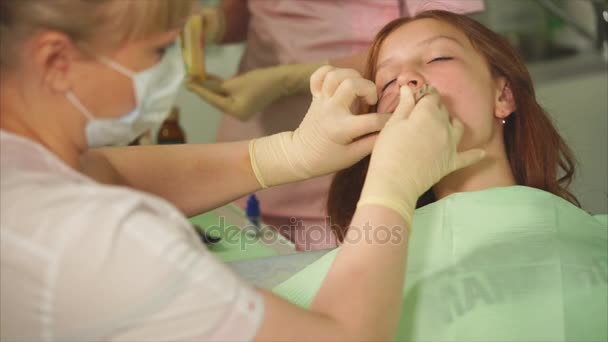 Zahnarzt, der Verbände zwischen Zahnfleisch und Zähnen einsetzt, um die Mundhöhle zu behandeln — Stockvideo