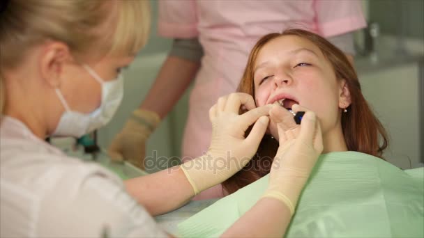 Afwerking van tandvulling. Tandarts met behulp van speciale spuit met tandvulling — Stockvideo