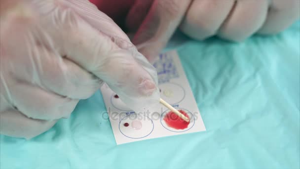 Mezcla de sangre y disolución de anticuerpos en el panel de ensayo — Vídeo de stock